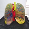 Medical teaching sample 3 - PolyJet 3D printing